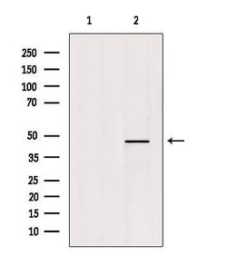 Invitrogen LMX1B Polyclonal Antibody 100 &mu;L; Unconjugated:Antibodies,