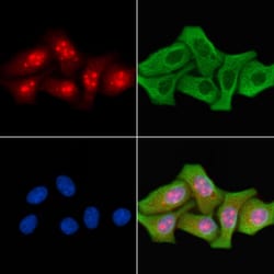 Invitrogen TBX10 Polyclonal Antibody 100 &mu;L; Unconjugated:Antibodies,