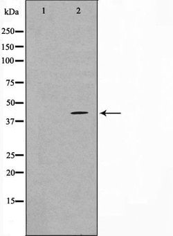 Invitrogen TBX10 Polyclonal Antibody 100 &mu;L; Unconjugated:Antibodies,