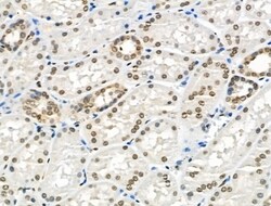 Invitrogen TAF5L Polyclonal Antibody 100 &mu;L | Buy Online | Invitrogen&trade; | Fisher Scientific