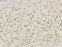 Invitrogen TAF5L Polyclonal Antibody 100 &mu;L | Buy Online | Invitrogen&trade; | Fisher Scientific