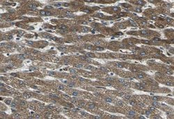 Invitrogen Thrombin Polyclonal Antibody 100 &mu;L | Buy Online | Invitrogen&trade; | Fisher Scientific