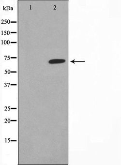 Invitrogen Thrombin Polyclonal Antibody 100 &mu;L | Buy Online | Invitrogen&trade; | Fisher Scientific