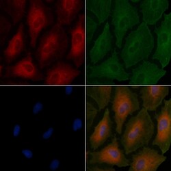 Invitrogen TSPAN8 Polyclonal Antibody 100 &mu;L; Unconjugated:Antibodies,