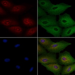 Invitrogen TSPAN8 Polyclonal Antibody 100 &mu;L; Unconjugated:Antibodies,