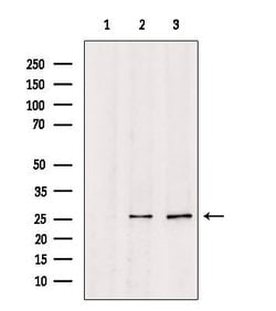 Invitrogen TSPAN8 Polyclonal Antibody 100 &mu;L; Unconjugated:Antibodies,