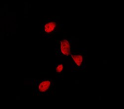 Invitrogen TFE3 Polyclonal Antibody 100 &mu;L; Unconjugated:Antibodies,