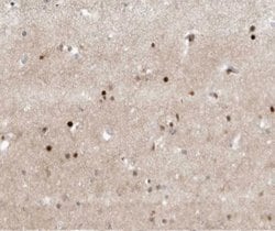 Invitrogen TFE3 Polyclonal Antibody 100 &mu;L; Unconjugated:Antibodies,