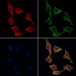 Invitrogen ABCF1 Polyclonal Antibody 100 &mu;L; Unconjugated:Antibodies,