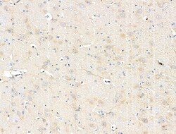 Invitrogen ABCF1 Polyclonal Antibody 100 &mu;L; Unconjugated:Antibodies,