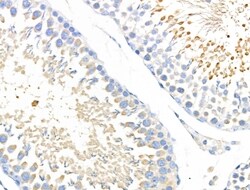 Invitrogen ABCF1 Polyclonal Antibody 100 &mu;L; Unconjugated:Antibodies,