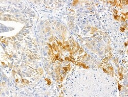 Invitrogen ABCF1 Polyclonal Antibody 100 &mu;L; Unconjugated:Antibodies,