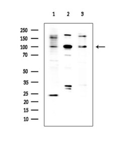 Invitrogen ABCF1 Polyclonal Antibody 100 &mu;L; Unconjugated:Antibodies,