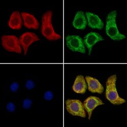 Invitrogen PTPN22 Polyclonal Antibody 100 &mu;L; Unconjugated:Antibodies,
