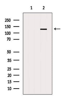 Invitrogen ADNP Polyclonal Antibody 100 &mu;L; Unconjugated:Antibodies,
