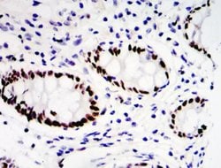 Invitrogen ETV4 Polyclonal Antibody 100 &mu;L; Unconjugated:Antibodies,