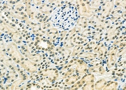 Invitrogen ETV4 Polyclonal Antibody 100 &mu;L; Unconjugated:Antibodies,