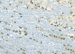 Invitrogen ETV4 Polyclonal Antibody 100 &mu;L; Unconjugated:Antibodies,