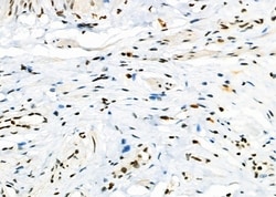 Invitrogen C1orf57 Polyclonal Antibody 100 &mu;L; Unconjugated:Antibodies,