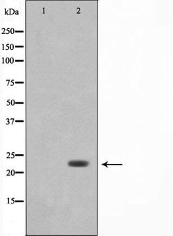 Invitrogen LDOC1L Polyclonal Antibody 100 &mu;L; Unconjugated:Antibodies,