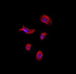 Invitrogen TACC1 Polyclonal Antibody 100 &mu;L; Unconjugated:Antibodies,