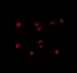 Invitrogen ZNF498 Polyclonal Antibody 100 &mu;L; Unconjugated:Antibodies,