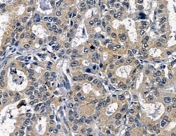 Invitrogen SLC4A1AP Polyclonal Antibody 100 &mu;L; Unconjugated:Antibodies,