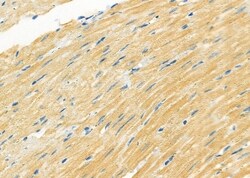 Invitrogen MN1 Polyclonal Antibody 100 &mu;L; Unconjugated:Antibodies,