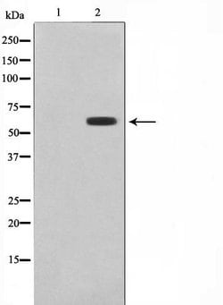Invitrogen CYP26A1 Polyclonal Antibody 100 &mu;L; Unconjugated:Antibodies,