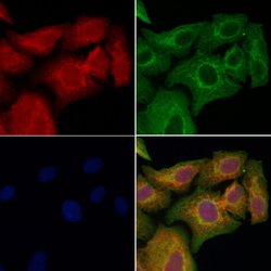 Invitrogen AGPAT9 Polyclonal Antibody 100 &mu;L; Unconjugated:Antibodies,