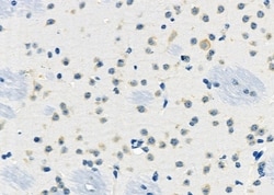 Invitrogen AGPAT9 Polyclonal Antibody 100 &mu;L; Unconjugated:Antibodies,