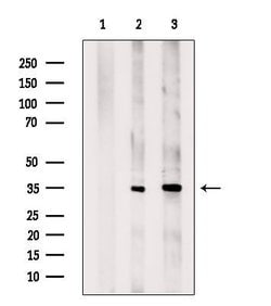 Invitrogen AGPAT9 Polyclonal Antibody 100 &mu;L; Unconjugated:Antibodies,