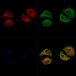Invitrogen LRAT Polyclonal Antibody 100 μL; Unconjugated:Antibodies,