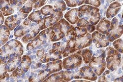 Invitrogen LRAT Polyclonal Antibody 100 μL; Unconjugated:Antibodies,