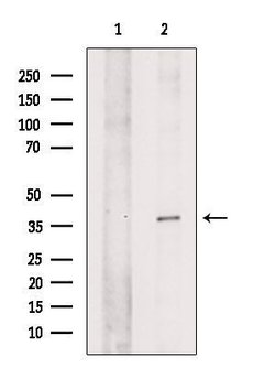 Invitrogen LRAT Polyclonal Antibody 100 μL; Unconjugated:Antibodies,