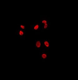 Invitrogen MAST3 Polyclonal Antibody 100 &mu;L; Unconjugated:Antibodies,