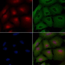Lass4 Polyclonal Antibody:Antibodies, Polyclonal
