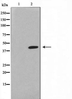 Lass4 Polyclonal Antibody:Antibodies, Polyclonal