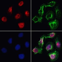 Invitrogen VPS72 Polyclonal Antibody 100 &mu;L; Unconjugated:Antibodies,