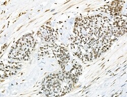 Invitrogen VPS72 Polyclonal Antibody 100 &mu;L; Unconjugated:Antibodies,