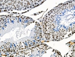 Invitrogen VPS72 Polyclonal Antibody 100 &mu;L; Unconjugated:Antibodies,