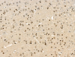 Invitrogen VPS72 Polyclonal Antibody 100 &mu;L; Unconjugated:Antibodies,