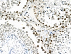 Invitrogen VPS72 Polyclonal Antibody 100 &mu;L; Unconjugated:Antibodies,