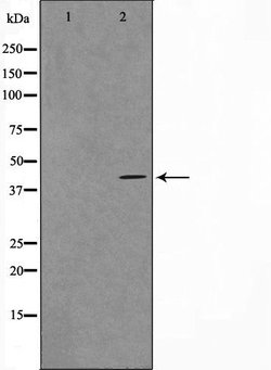 Invitrogen VPS72 Polyclonal Antibody 100 &mu;L; Unconjugated:Antibodies,