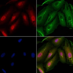 Invitrogen ARMX3 Polyclonal Antibody 100 &mu;L; Unconjugated:Antibodies,