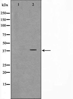 Invitrogen ARMX3 Polyclonal Antibody 100 &mu;L; Unconjugated:Antibodies,