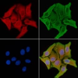 Invitrogen ADPGK Polyclonal Antibody 100 &mu;L; Unconjugated:Antibodies,