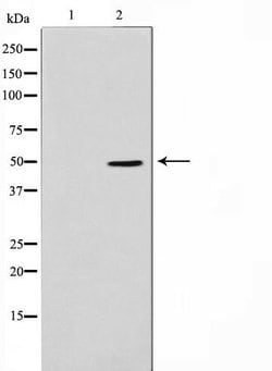 Invitrogen ADPGK Polyclonal Antibody 100 &mu;L; Unconjugated:Antibodies,