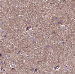 Invitrogen ACTG2 Polyclonal Antibody 100 &mu;L; Unconjugated:Antibodies,