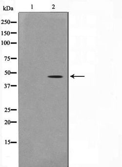 Invitrogen ACTG2 Polyclonal Antibody 100 &mu;L; Unconjugated:Antibodies,